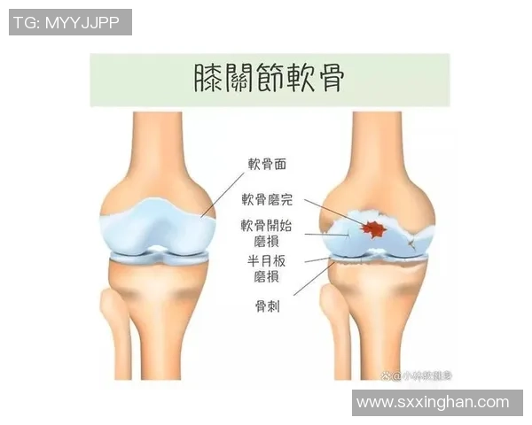 踢足球对膝盖的影响及预防运动伤害的有效措施探讨